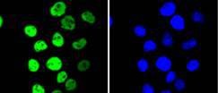 Anti-Phospho-RPS6KA5 (Ser376) Antibody (8P256)
