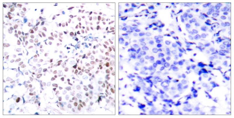 Anti-Phospho-MYC (Thr358) Polyclonal Antibody