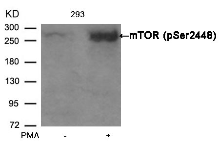 Anti-Phospho-mTOR (Ser2448) Polyclonal Antibody 2
