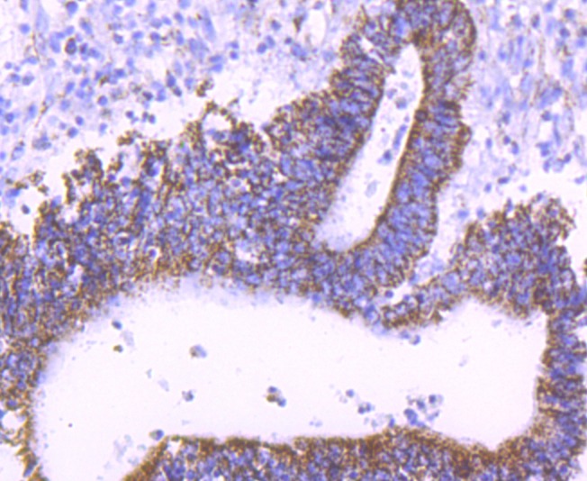 Anti-mtTFA Antibody (9N379)