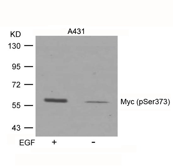 Anti-Phospho-MYC (Ser373) Polyclonal Antibody