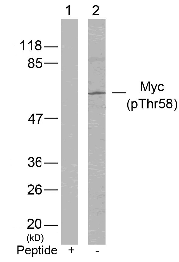 Anti-Phospho-MYC (Thr58) Polyclonal Antibody