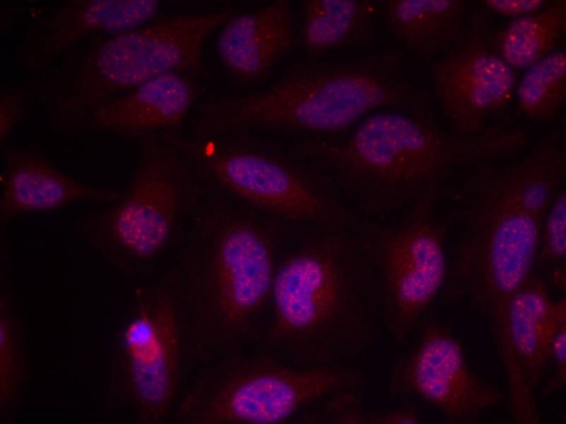 Anti-Phospho-MYC (Thr358) Polyclonal Antibody