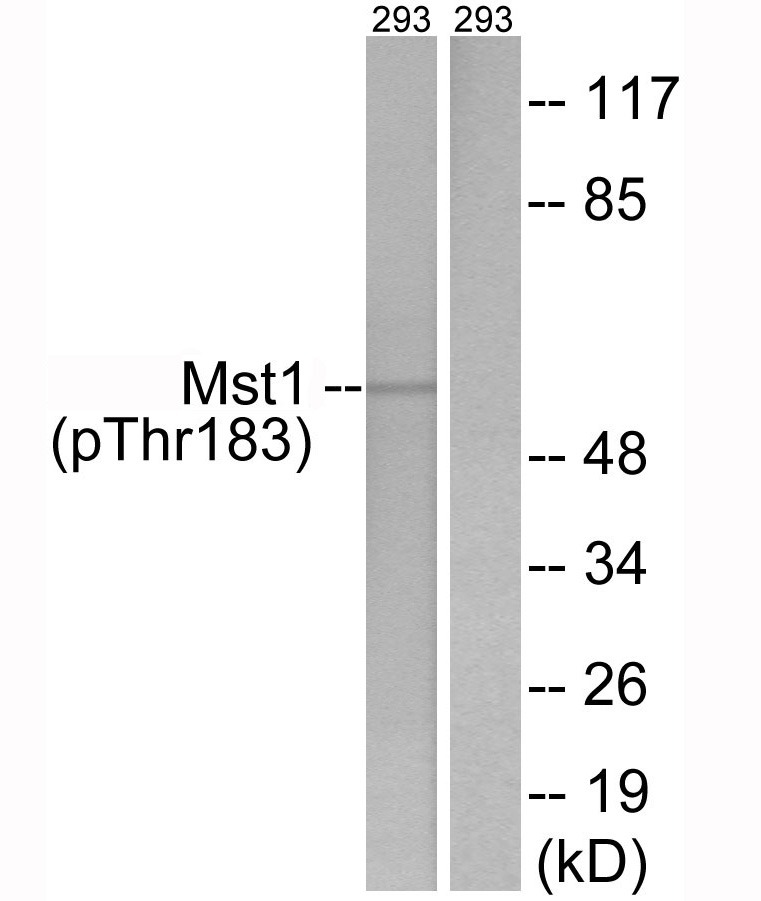 Anti-Phospho-MST1 (Thr183) Polyclonal Antibody 2