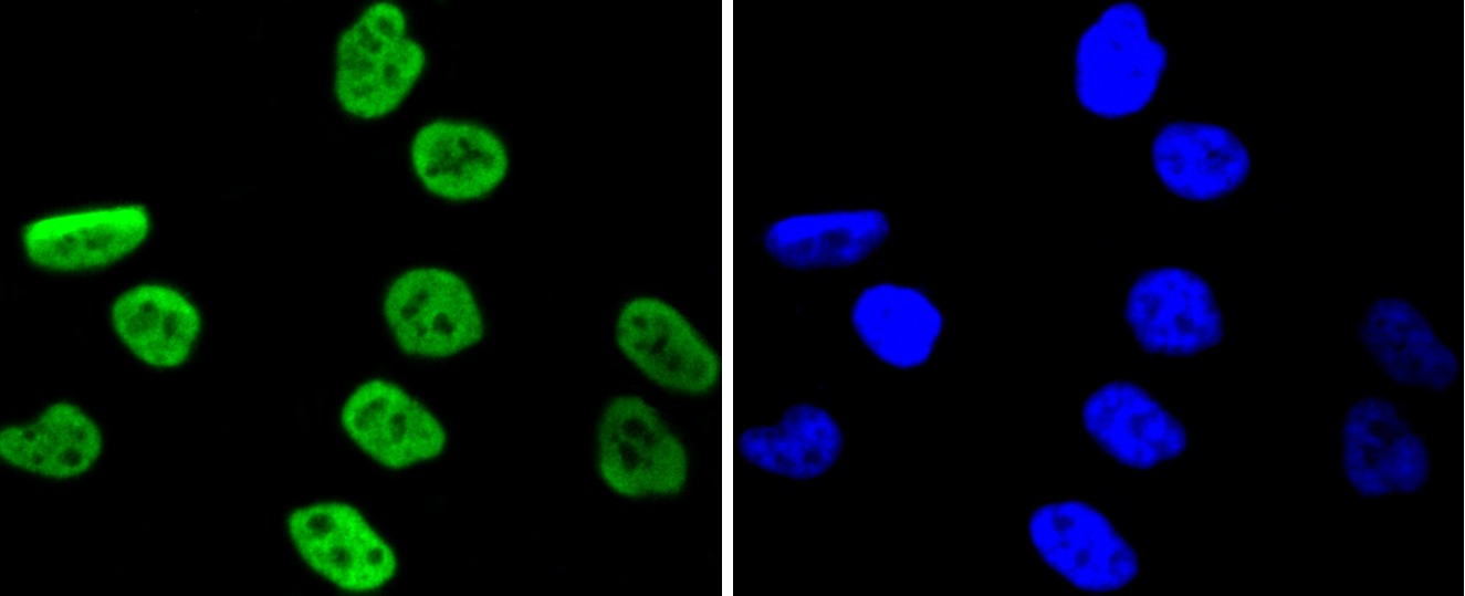 Anti-Phospho-RPS6KA5 (Ser376) Antibody (8P256)
