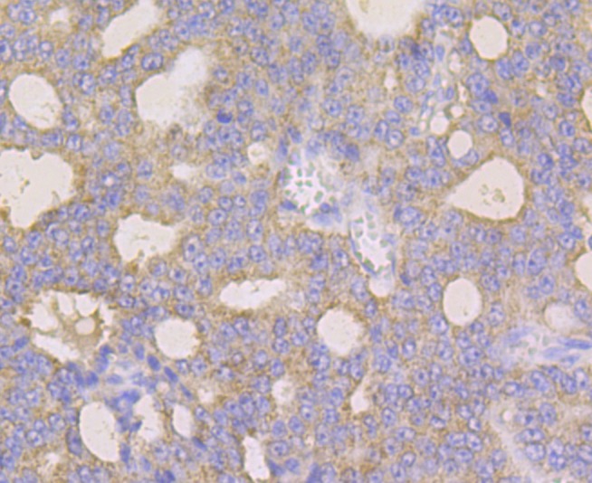 Anti-MAOB Antibody (1T245)