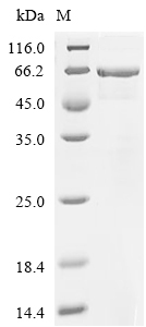 Nmi Protein, Mouse, Recombinant (His & GST)