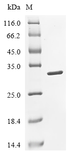 Carbonic Anhydrase 2 Protein, Human, Recombinant (HEK293, His)