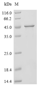 RAD51AP1 Protein, Human, Recombinant (His)
