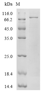 CGAS Protein, Mouse, Recombinant (His)
