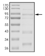 DYRK1A Protein, Rat, Recombinant (GST)