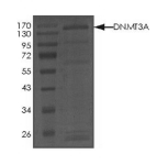 DNMT3A Protein, Human, Recombinant (GST)