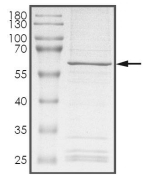 CCRK Protein, Mouse, Recombinant (GST)