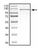 DGKZ Protein, Human, Recombinant (His)