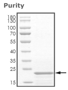 CALM1 Protein, Human, Recombinant (His)