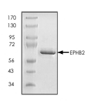 EphB2 Protein, Human, Recombinant (aa 570-1055, GST)