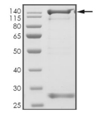 DGKD Protein, Human, Recombinant (GST)