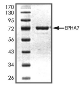 EphA7 Protein, Mouse, Recombinant (GST)