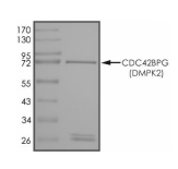 CDC42BPG Protein, Human, Recombinant (GST)