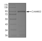 CAMKK2 Protein, Human, Recombinant (GST)