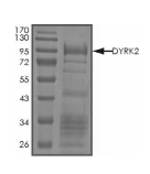 DYRK2 Protein, Human, Recombinant (GST)