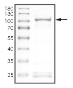 DYRK1B Protein, Human, Recombinant (GST)