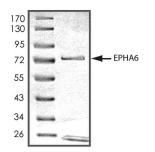 EphA6 Protein, Human, Recombinant (GST)