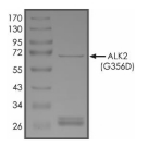 ALK-2/ACVR1 Protein, Human, Recombinant (G356D, GST)