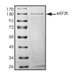 EEF2K Protein, Human, Recombinant (GST)