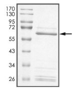 AURORA B, Human, Recombinant (GST)
