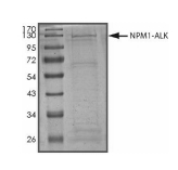 NPM1-ALK Protein, Human, Recombinant (GST)