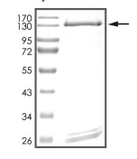 DNMT3B Protein, Human, Recombinant (GST)