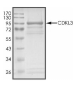 CDKL3/NKIAMRE Protein, Human, Recombinant (GST)