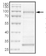 PRKAG3 Protein, Human, Recombinant (His & GST)