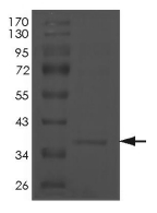 Cyclin H Protein, Human, Recombinant (His)