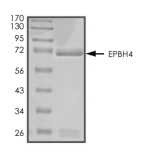 EphB4 Protein, Human, Recombinant (GST)