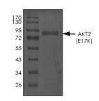 AKT2 Protein, Human, Recombinant (E17K, GST)