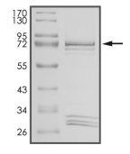 CK1 delta/CSNK1D Protein, Human, Recombinant (GST)