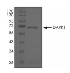 DAPK1 Protein, Human, Recombinant (GST)