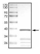 CDKN2B Protein, Human, Recombinant (GST)