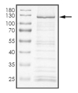 KIAA1549-BRAF Protein, Human, Recombinant (GST)