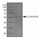 CDK5R1 Protein, Human, Recombinant (GST)