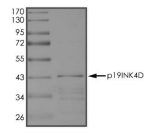 p19 INK4d Protein， Human, Recombinant (aa 1-166, GST)