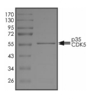 CDK5 & p35 Protein, Human, Recombinant (GST)
