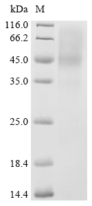 Leukotoxin Protein, Aggregatibacter actinomycetemcomitans, Recombinant (His)