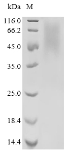 NR4A2 Protein, Human, Recombinant (His)
