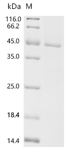 HSD11B2 Protein, Human, Recombinant (His)