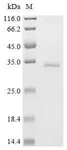 PARP9 Protein, Human, Recombinant (His & Myc)