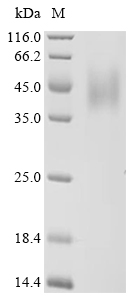 PARP14 Protein, Human, Recombinant (His & Myc)