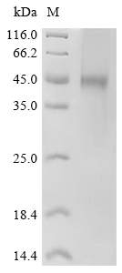 TMPRSS2 Protein, Human, Recombinant (His & Myc)